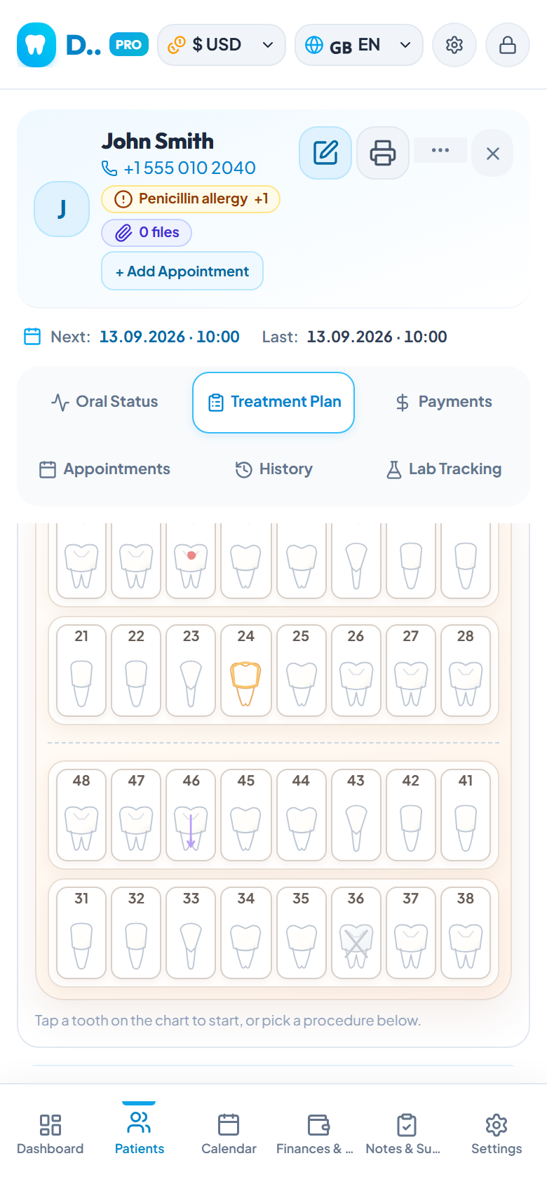 DentaX visual treatment plan tooth chart